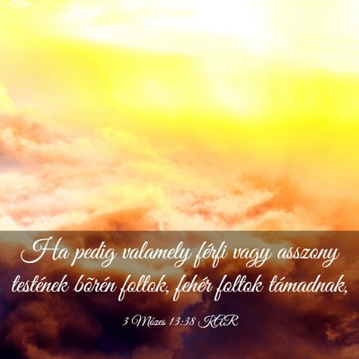 Picture 03 - 3 Mózes 13:38 KAR - Ha pedig valamely férfi vagy asszony testének - Bible Verse Picture