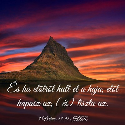 Picture 03 - 3 Mózes 13:41 KAR - És ha elõlrõl hull el a haja, elõl kopasz az, - Bible Verse Picture